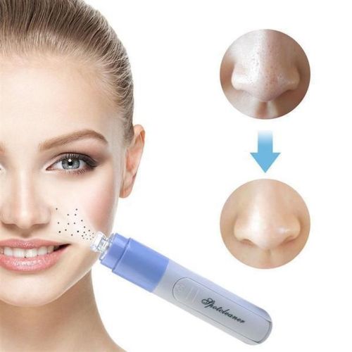 Вакуумный очиститель пор Facial Pore Cleaner для лица, от черных точек и прыщей