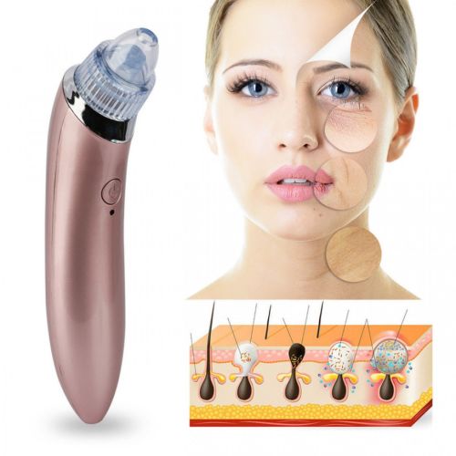 Вакуумный аппарат для лица Beauty Skin Care Specialist XN-8030 устройство очиститель, аппарат-очиститель пор для удаления акне, чистки кожи
