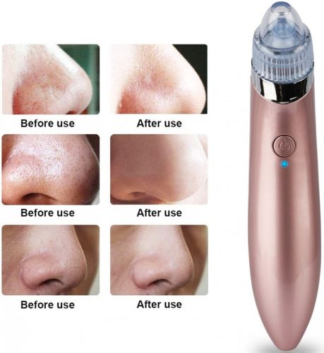 Вакуумный аппарат для лица Beauty Skin Care Specialist XN-8030 устройство очиститель, аппарат-очиститель пор для удаления акне, чистки кожи
