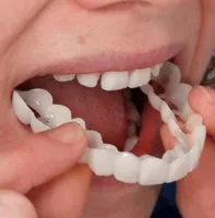 Знімні вініри на верхні і нижні щелепи SnapOn Smile Veneers LY-11 для зубів, вініри Снеп він Смайл 2 щелепи з кейсом, накладні зуби верх, вниз