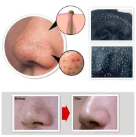 Черная маска для лица Dermacol Black Peel Off Mask в тюбике 120мл. против Угрей и Черных Точек