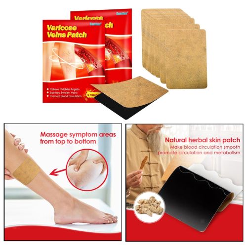 Тілесний пластир від варикозу KanyeHB Varicose Veins Plaster 6 шт, Комплект патчів від варикозного розширення вен і васкуліту, антиварикозні пластирі