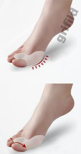 Фіксатор для корекції великих пальців Valgus Pro Коректор кісточки коректор
