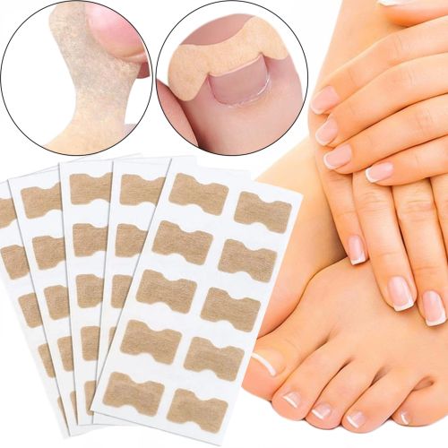 Набір пластирів Elastic Toenail Correction Sticker 50 шт для корекції вростаючих нігтів тілесний пластир наклейка для усунення врослого нігтя