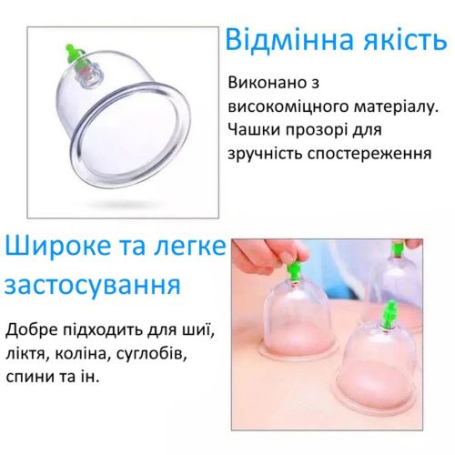  Вакуумні масажні антицелюлітні банки з насосом-Pull Out a Vacuum Apparatus KL 12 шт, Медичний набір з 12 вакуумних банок для масажу