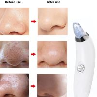 Вакуумный аппарат Derma Suction прибор для чистки пор и удаления черных точек, пилинг для лица, очиститель, аппарат-очиститель кожи 4 насадки Белый