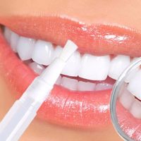 Олівець для відбілювання зубів Teeth Whitening dazzling White відбілюючі гель засіб для освітлення зубної емалі, відбілювач гель-олівець 2 мл