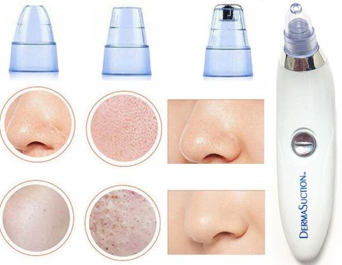 Вакуумный аппарат Derma Suction прибор для чистки пор и удаления черных точек, пилинг для лица, очиститель, аппарат-очиститель кожи 4 насадки Белый