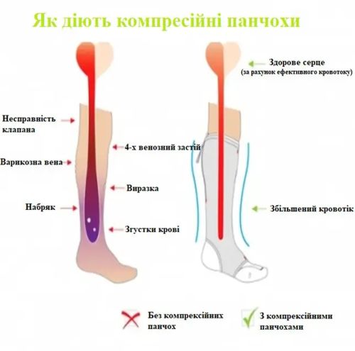 Компресійні гольфи від варикозу Zip Sox, облягаючі лікувальні панчохи, шкарпетки для фіксації щиколоток Зіп Сокс зі змійкою, Бежеві S/M, L/XL