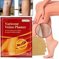 Тілесний пластир від варикозу KanyeHB Varicose Veins Plaster 6 шт, Комплект патчів від варикозного розширення вен і васкуліту, антиварикозні пластирі